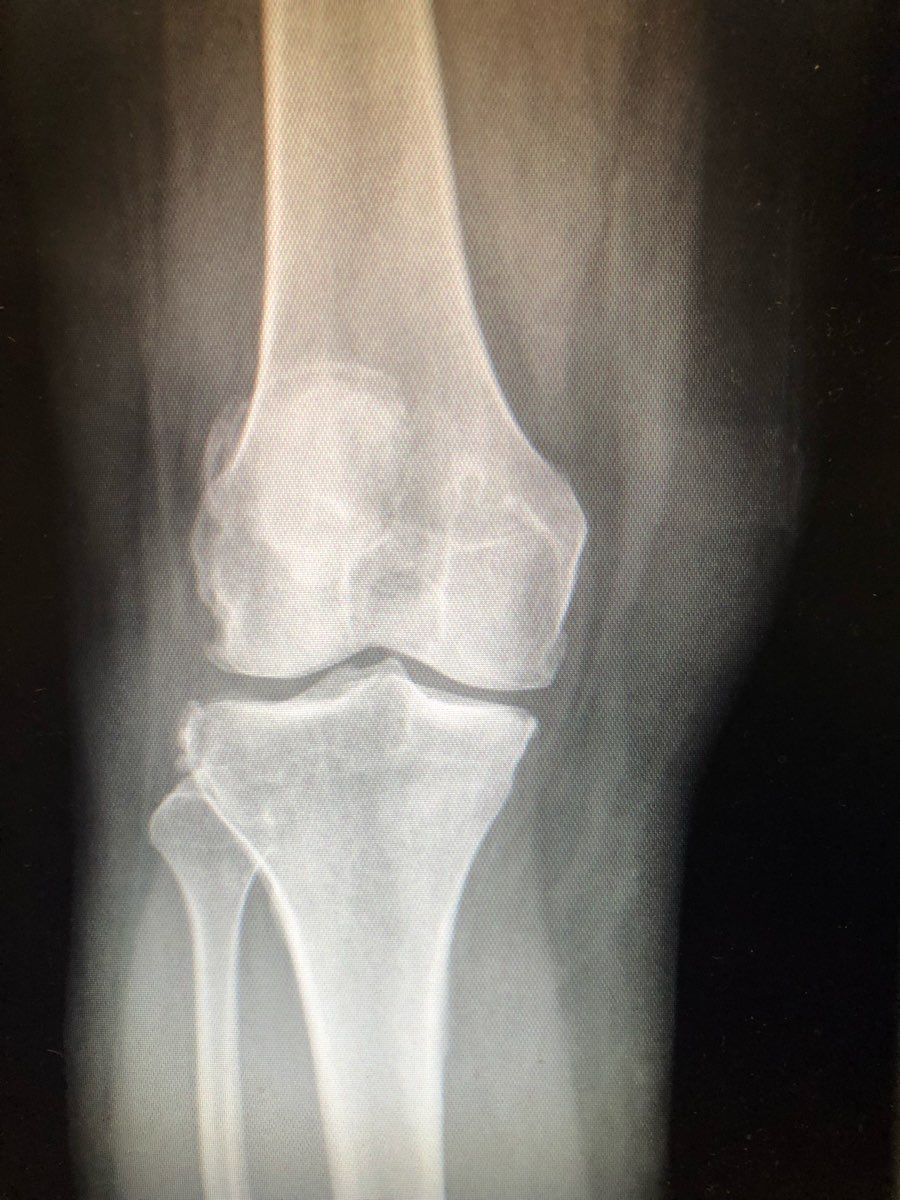 2314B981-4CA6-4C6D-AA02-5326388ABA81