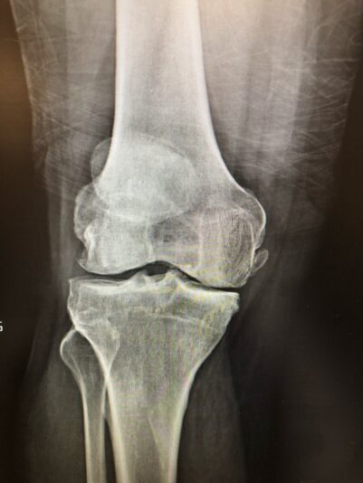 A49D40F5-5BD4-4EE5-A51C-E1FD81C448DB