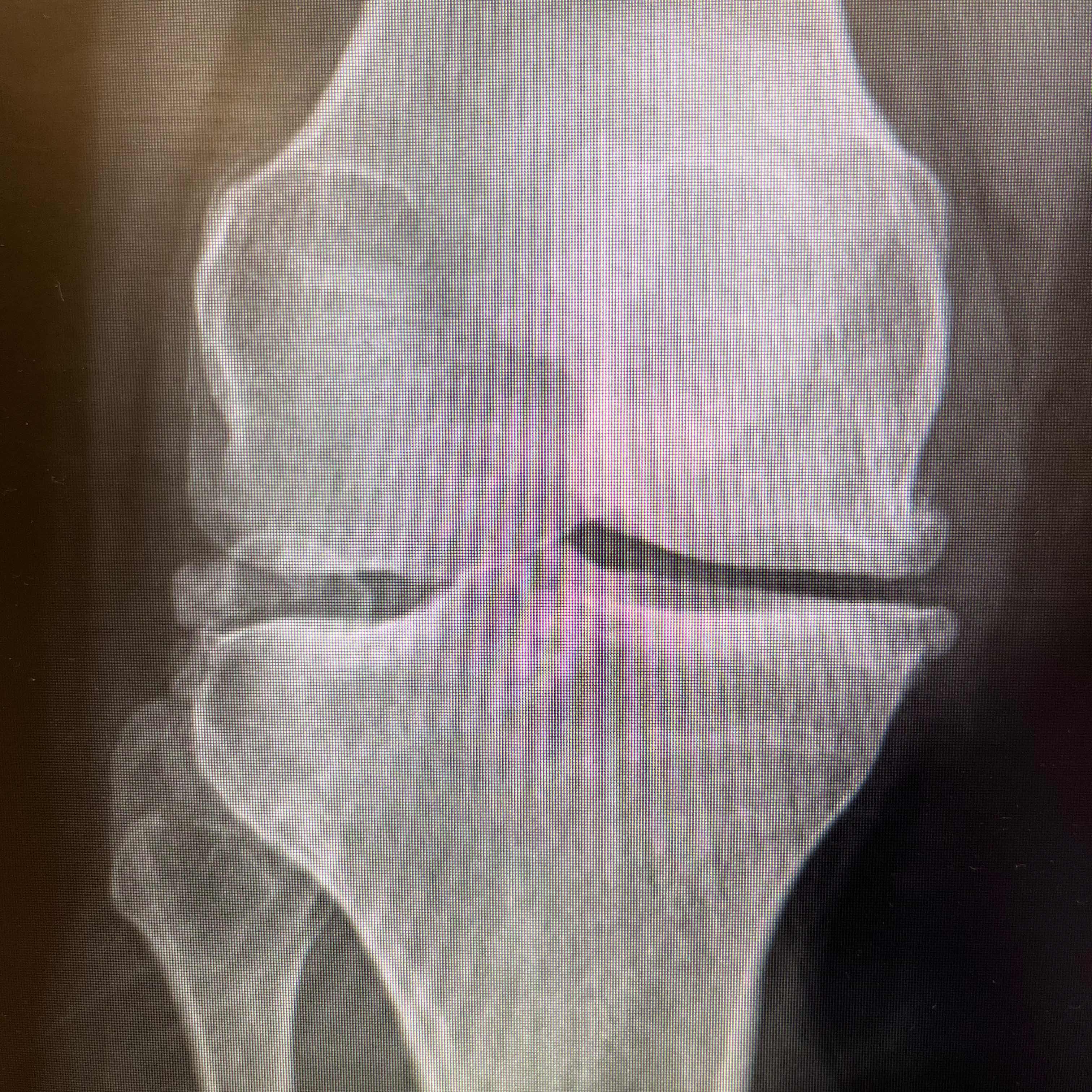 CC2DD388-9E9B-43D0-8B27-E7A09A3AA856