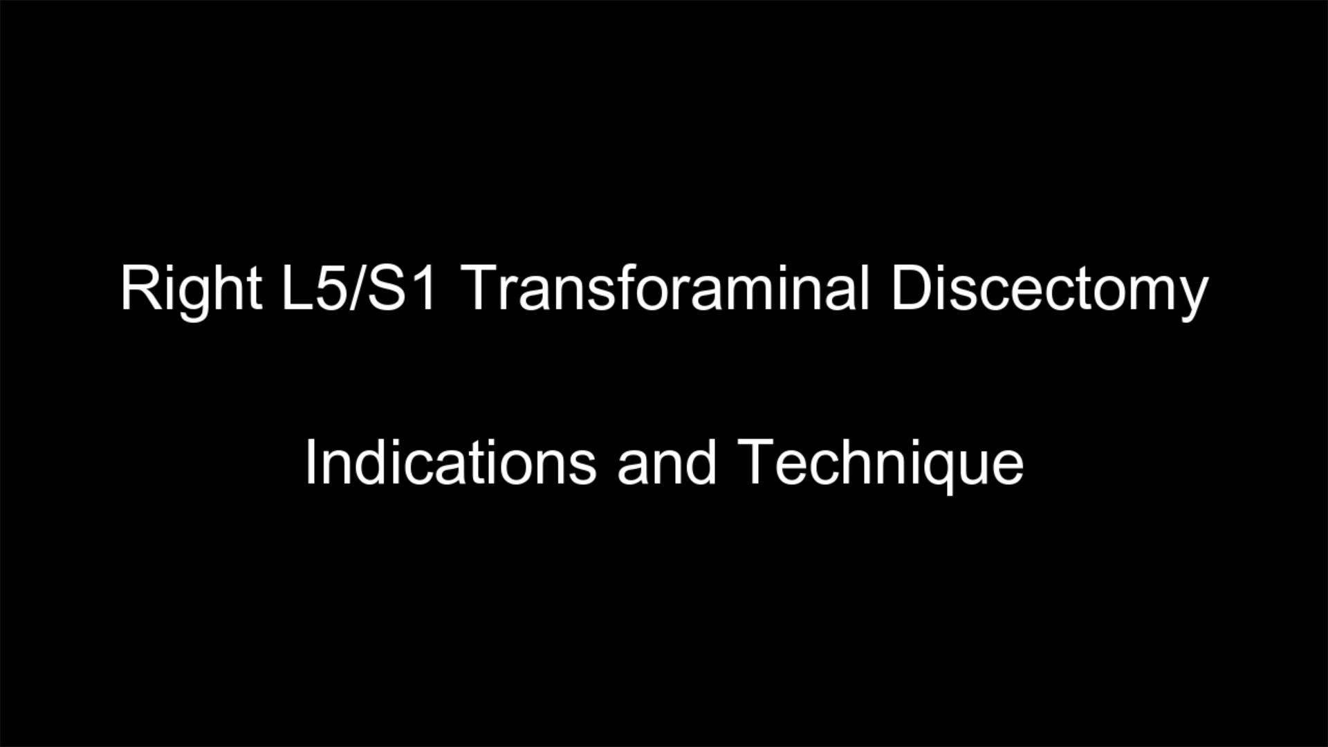 Endoscopic L5/S1 Transforaminal Discectomy and Doc Social