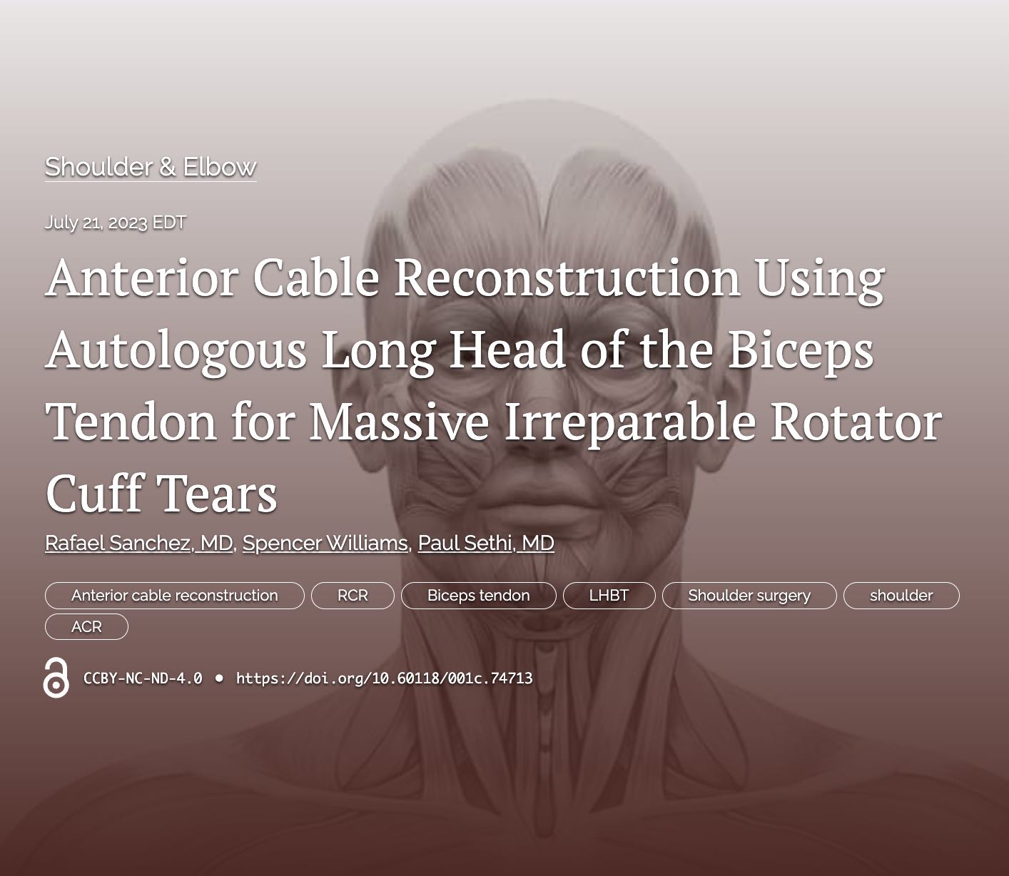Monosnap Anterior Cable Reconstruction Using Autologous Long Head of the Biceps Tendon for Massive Irreparable Rotator Cuff Tears | Publ… 2023-07-22 11-21-39